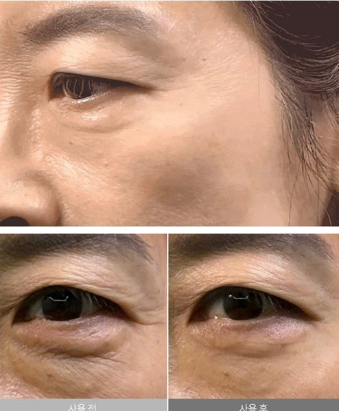 Kem Huỷ Nhăn Dr.Vita